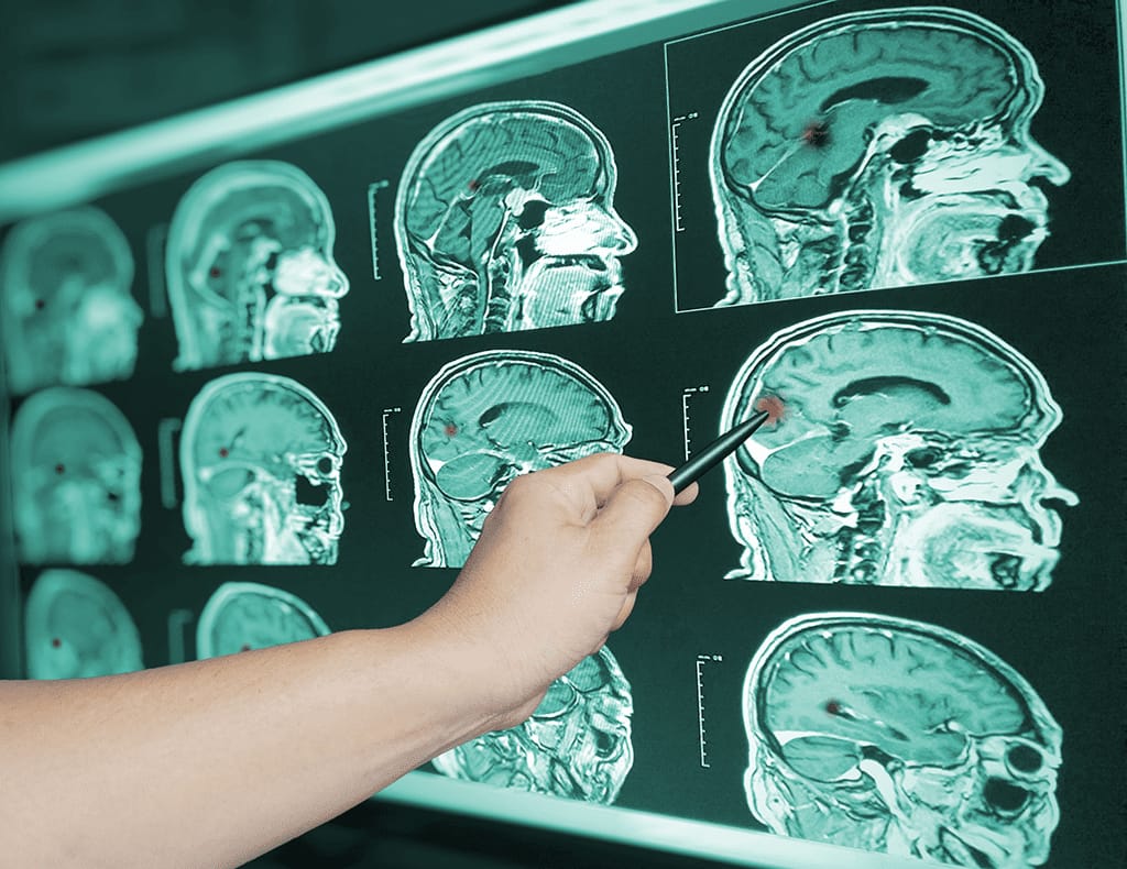 Brain scans with a hand reviewing medical images