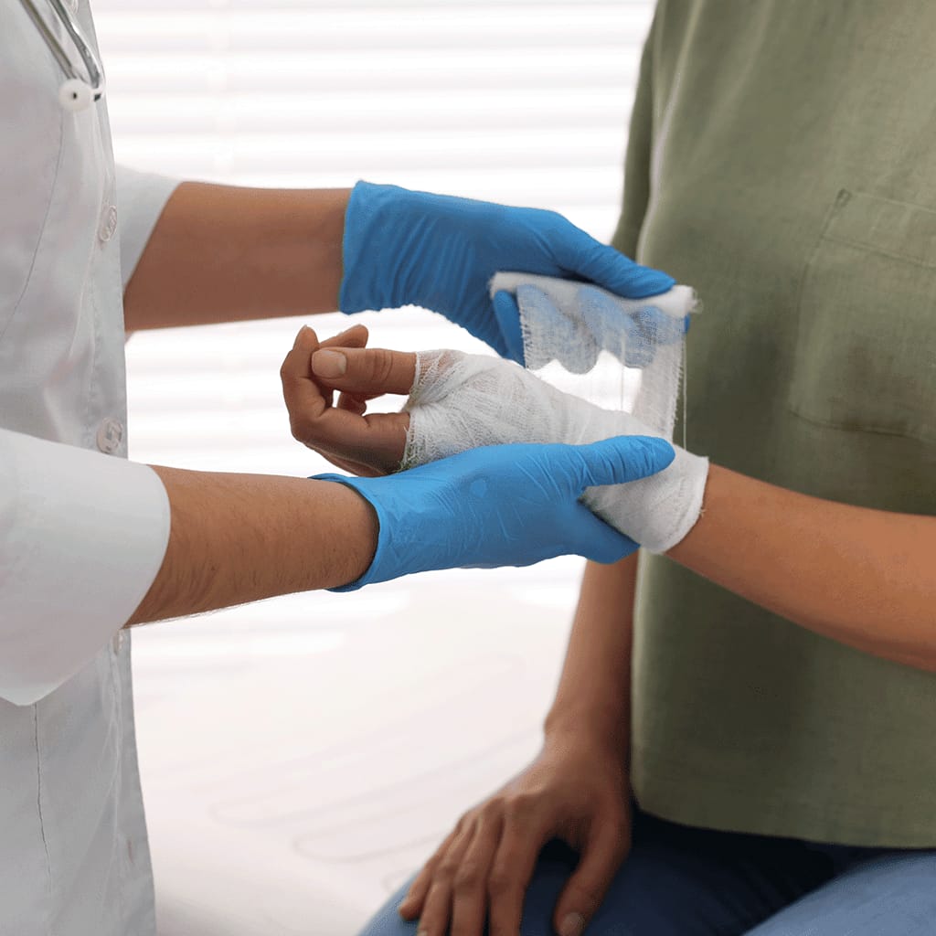 Hands tending a burn injury during medical care